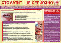 Санбюлетень "Стоматит"