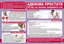 Санбюлетень "Аденома простати. На що не можна закривати очі"
